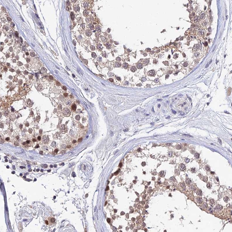 Anti-TEKT1 Antibody