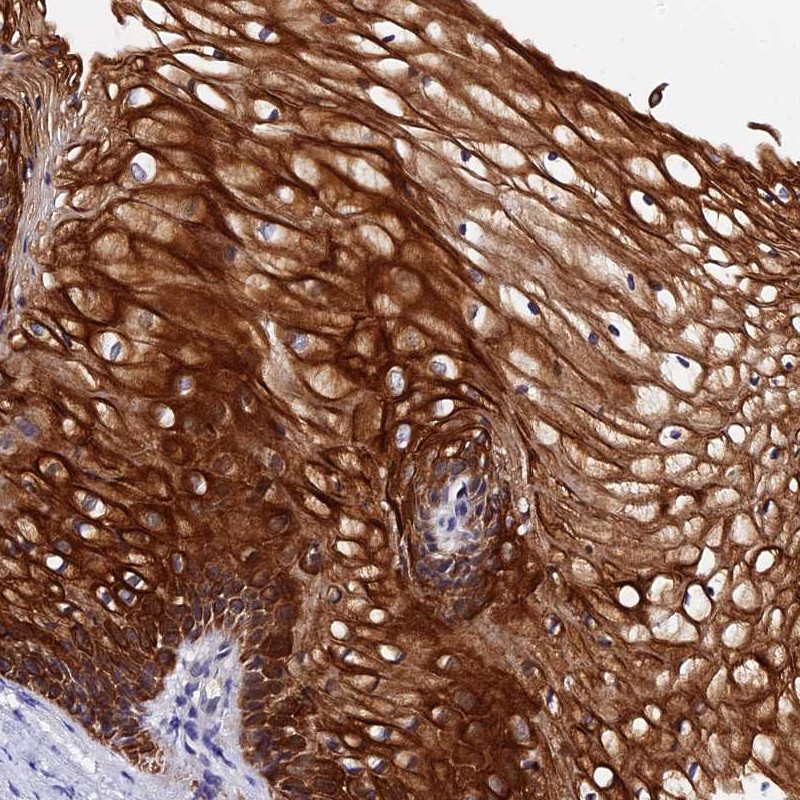 Anti-ZNF628 Antibody
