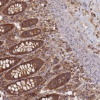 Anti-SHARPIN Antibody