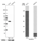 Western blot analysis in human cell lines PC-3 and Caco-2 using Anti-SHARPIN antibody. Corresponding SHARPIN RNA-seq data are presented for the same cell lines. Loading control: Anti-HSP90B1.