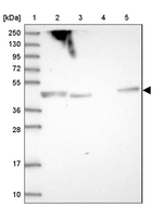 Lane 1: Marker [kDa] 250, 130, 95, 72, 55, 36, 28, 17, 10_br/_Lane 2: Human cell line RT-4_br/_Lane 3: Human cell line U-251MG sp_br/_Lane 4: Human plasma (IgG/HSA depleted)_br/_Lane 5: Human liver tissue