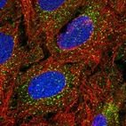 Anti-TBX4 Antibody