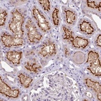 Anti-TMEM62 Antibody