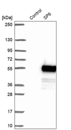 Anti-SP6 Antibody