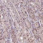 Anti-KAT7 Antibody