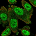 Immunofluorescent staining of human cell line PC-3 shows localization to nucleoplasm.