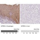 Anti-SPRR3 Antibody