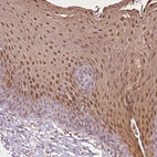 Immunohistochemical staining of human esophagus shows moderate cytoplasmic and nuclear positivity in squamous epithelial cells.