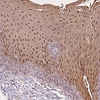 Immunohistochemical staining of human esophagus shows moderate cytoplasmic and nuclear positivity in squamous epithelial cells.
