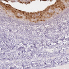 Immunohistochemical staining of human tonsil shows moderate to strong cytoplasmic and nuclear positivity in squamous epithelial cells.