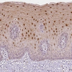Immunohistochemical staining of human uterine cervix shows moderate cytoplasmic and nuclear positivity in squamous epithelial cells.
