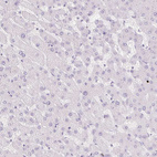 Anti-SPRR3 Antibody