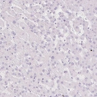 Immunohistochemical staining of human liver shows no positivity in hepatocytes as expected.