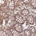 Anti-SDCCAG8 Antibody