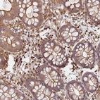 Anti-SDCCAG8 Antibody