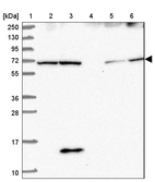 Lane 1: Marker [kDa] 250, 130, 95, 72, 55, 36, 28, 17, 10_br/_Lane 2: Human cell line RT-4_br/_Lane 3: Human cell line U-251MG sp_br/_Lane 4: Human plasma (IgG/HSA depleted)_br/_Lane 5: Human liver tissue_br/_Lane 6: Human tonsil tissue