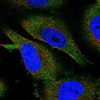 Immunofluorescent staining of human cell line U-251 MG shows localization to cytosol.