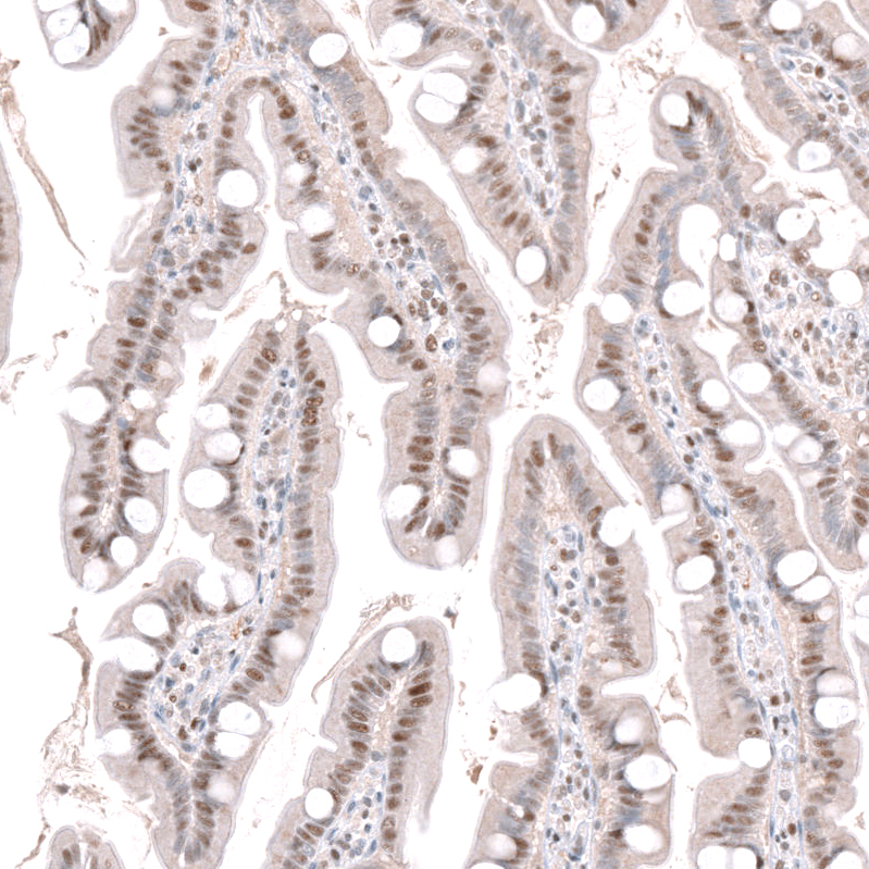 Anti-DCAF13 Antibody