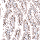 Anti-DCAF13 Antibody