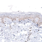 Immunohistochemical staining of human skin shows strong nuclear positivity in squamous epithelial cells.