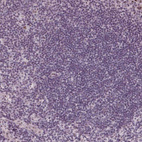 Anti-DNTTIP2 Antibody