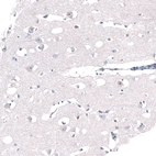 Immunohistochemical staining of human cerebral cortex shows strong positivity in nucleoli in neurons.