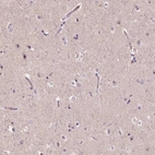 Immunohistochemical staining of human cerebral cortex shows strong positivity in nucleoli in neurons.