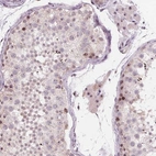Immunohistochemical staining of human testis shows strong positivity in nucleoli in Leydig cells and seminiferous duct cells.