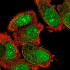 Immunofluorescent staining of human cell line PC-3 shows localization to nucleus, nucleoli & cytosol.