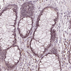 Anti-DNTTIP2 Antibody