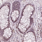 Immunohistochemical staining of human rectum shows strong positivity in nucleoli in glandular cells.