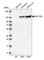 Western blot analysis in U2OS cells transfected with control siRNA, target specific siRNA probe #1 and #2, using Anti-DNTTIP2 antibody. Remaining relative intensity is presented.