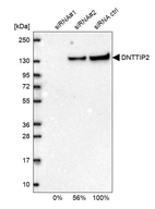 Western blot analysis in U2OS cells transfected with control siRNA, target specific siRNA probe #1 and #2, using Anti-DNTTIP2 antibody. Remaining relative intensity is presented.
