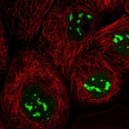 Immunofluorescent staining of human cell line A-431 shows localization to nucleoli.
