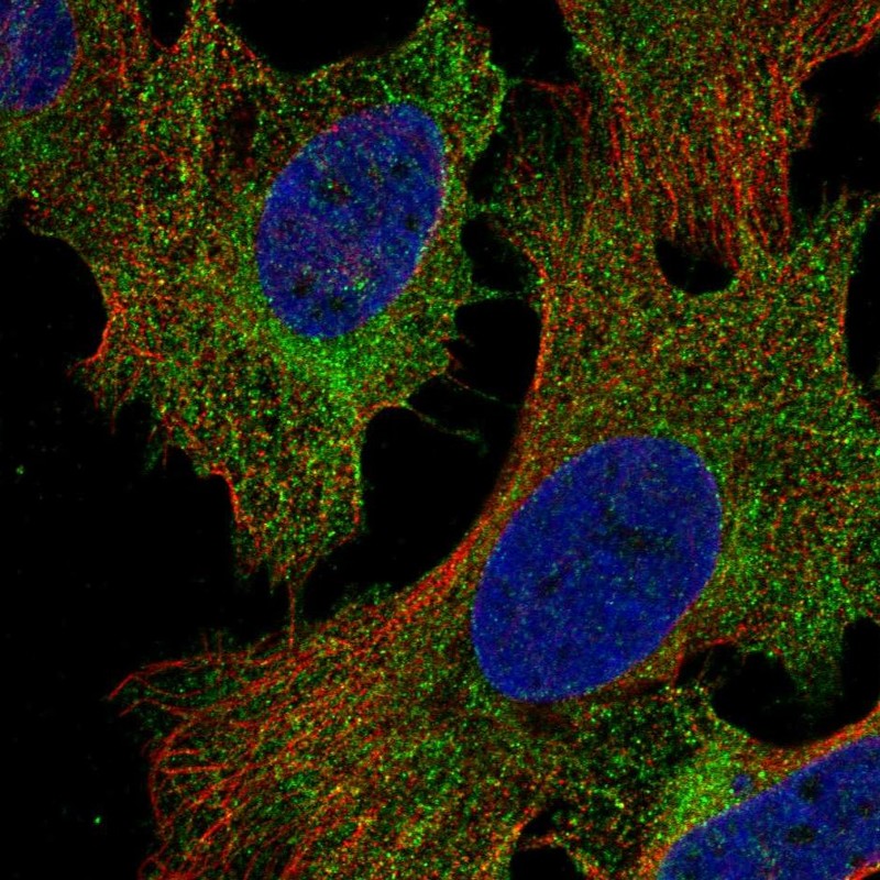 Anti-PIK3R5 Antibody