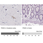 Anti-PNOC Antibody