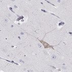 Immunohistochemical staining of human cerebral cortex shows high expression.