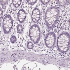 Immunohistochemical staining of human colon shows low expression as expected.