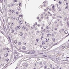 Immunohistochemical staining of human testis using Anti-PNOC antibody HPA044507.