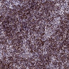 Anti-AFF3 Antibody