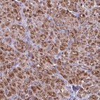 Anti-POMGNT1 Antibody