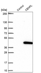 Western blot analysis in control (vector only transfected HEK293T lysate) and CENPL over-expression lysate (Co-expressed with a C-terminal myc-DDK tag (~3.1 kDa) in mammalian HEK293T cells, LY409603).
