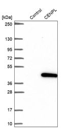 Western blot analysis in control (vector only transfected HEK293T lysate) and CENPL over-expression lysate (Co-expressed with a C-terminal myc-DDK tag (~3.1 kDa) in mammalian HEK293T cells, LY409603).