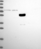 Lane 1: Marker [kDa] 250, 130, 95, 72, 55, 36, 28, 17, 10 _br/_ Lane 2: RT-4 _br/_ Lane 3: U-251 MG _br/_ Lane 4: Human Plasma _br/_ Lane 5: Liver _br/_ Lane 6: Tonsil