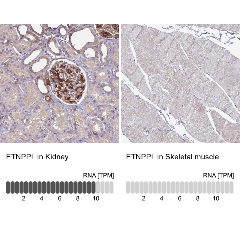Anti-ETNPPL Antibody