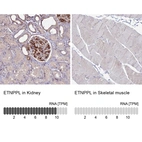 Anti-ETNPPL Antibody