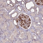 Immunohistochemical staining of human kidney shows moderate to strong cytoplasmic positivity in cells in glomeruli.