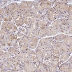 Immunohistochemical staining of human stomach shows moderate cytoplasmic positivity in glandular cells.