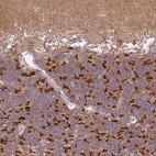 Immunohistochemical staining of human cerebellum shows strong cytoplasmic positivity in cells in granular layer.