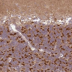 Immunohistochemical staining of human cerebellum shows strong cytoplasmic positivity in cells in granular layer.
